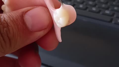 prosthodontics