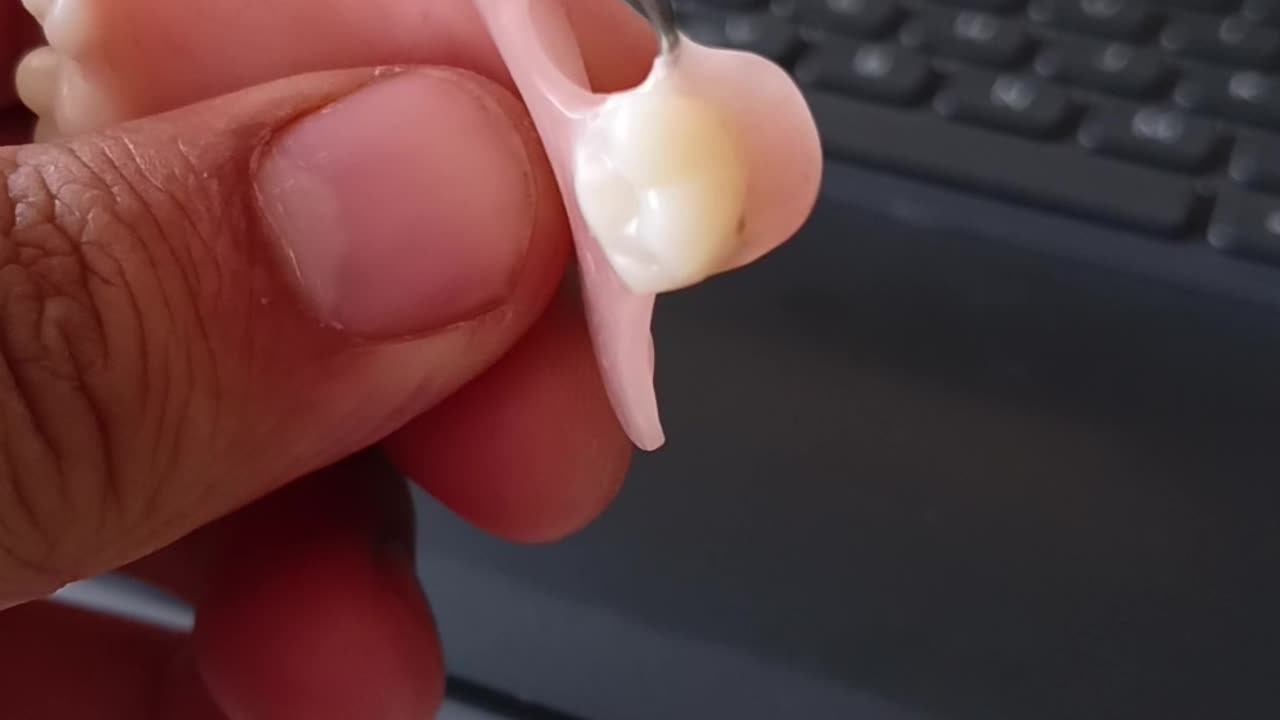 prosthodontics