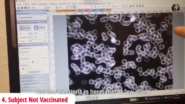 WATCH/This is why they don't want us using Ivermectin, parasites laying eggs in the vaccines.