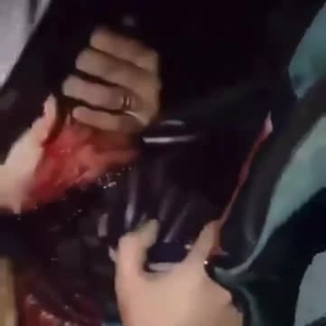 This Palestinian child was injured in the neck and they could do nothing for him