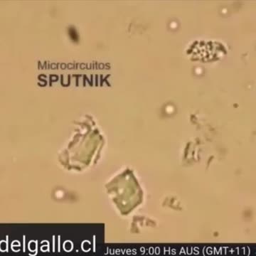 👀Russian💉SPUTNIK-V🧬 under a 🔬Microscope❗️🔥❗️
