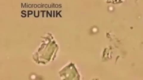 👀Russian💉SPUTNIK-V🧬 under a 🔬Microscope❗️🔥❗️