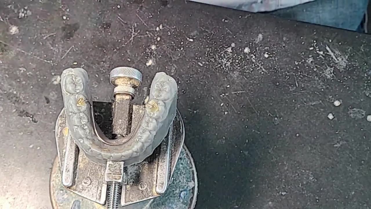 RetainerDesigner Ortho Lab Live Stream