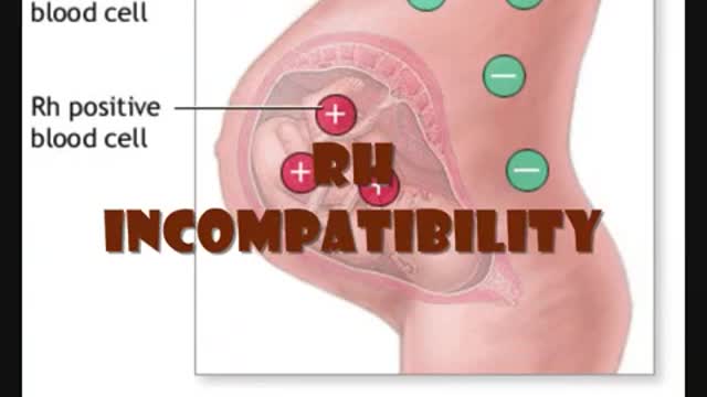 The RH Negative Blood Type: Two Seeds