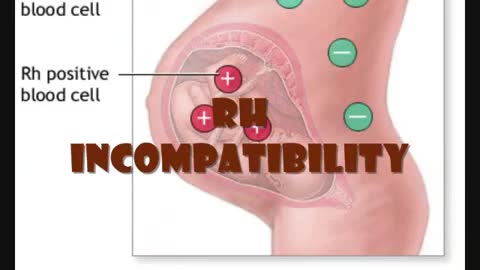 The RH Negative Blood Type: Two Seeds