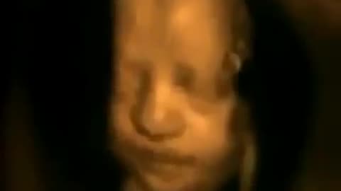 "If it’s not a human being, then why are you harvesting organs from it?" - Dr. Ben