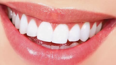 GET PERFECT TEETH IN TEN MINUTES