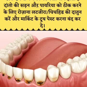 Teeth tips