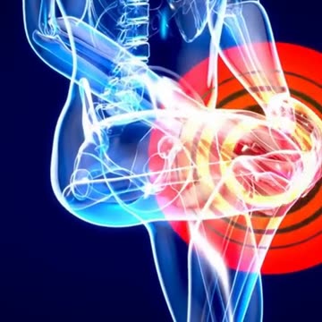 How do we treat vitamin D deficiency naturally