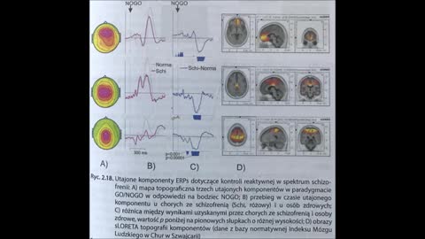 2.1 JA UTRACONE I ODZYSKANE 2.0 SPEKTRUM SCHIZOFRENII I ROZPAD SYSTEMU JA cd