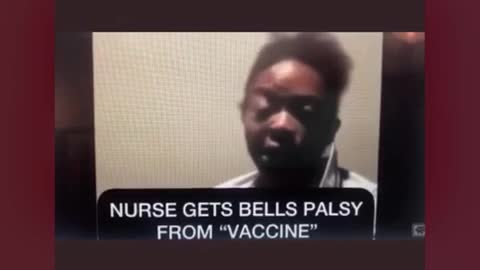 Nurse gets Bell Palsy from covid jab