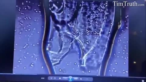 WTF IS IN PFIZER VACCINE?