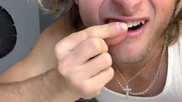 TOPPER GUILD LOSES TOOTH PRANK - #Shorts