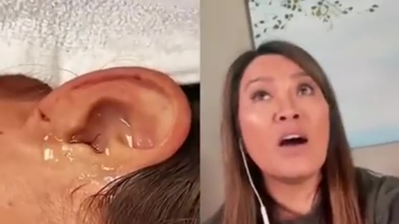 Live Insect In Ear! Dr Pimple Popper Reacts