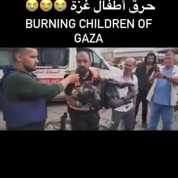 Gaza youth burned by terrorist child rapist killer jews from israel (1).mp4