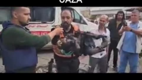 Gaza youth burned by terrorist child rapist killer jews from israel (1).mp4