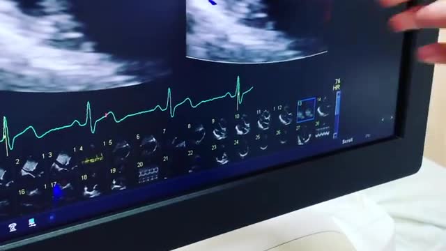 Echographe cardiovasculaire de Florian Dagoury à l’hôpital de Bangkok en Thaïlande