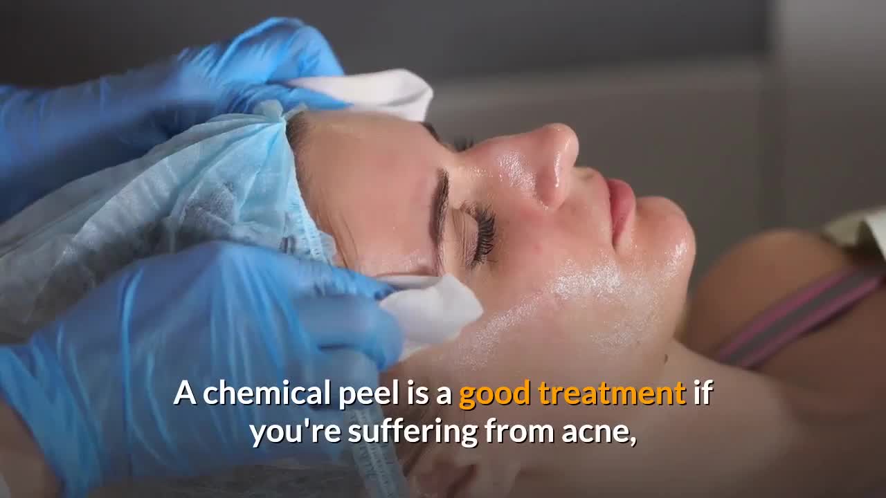 Chemical Peel Treatments For Smooth, Unblemished, Younger Looking Skin