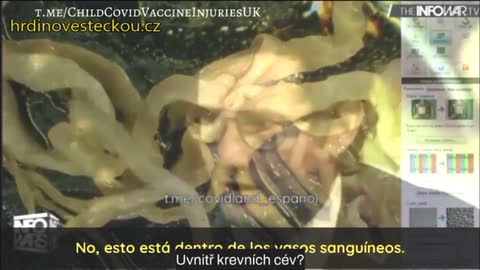 Sraženiny z mrtvých po vax