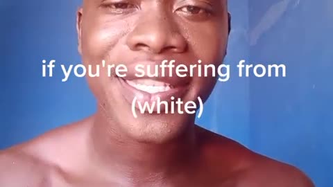 Girls Those suffering from white