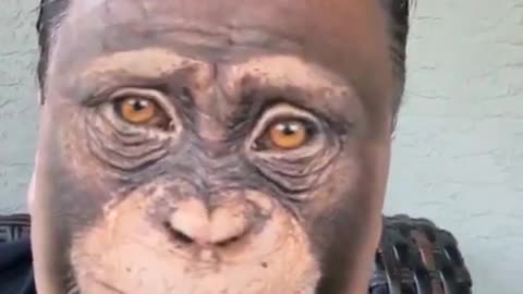 Monkeypox