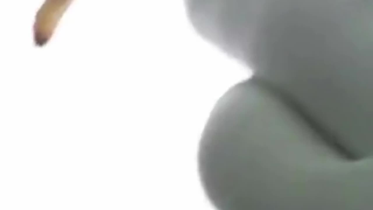BOTFLY EGGS IN HIS HEAD