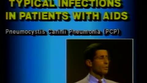 AIDS/Dr. Anthony Fauci (NIH, 1984)