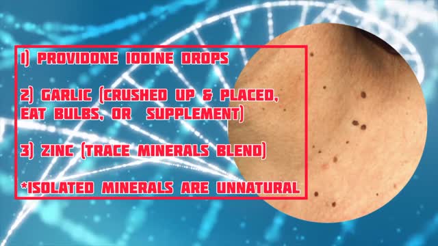 Skin Tags/Warts Natural Remedies