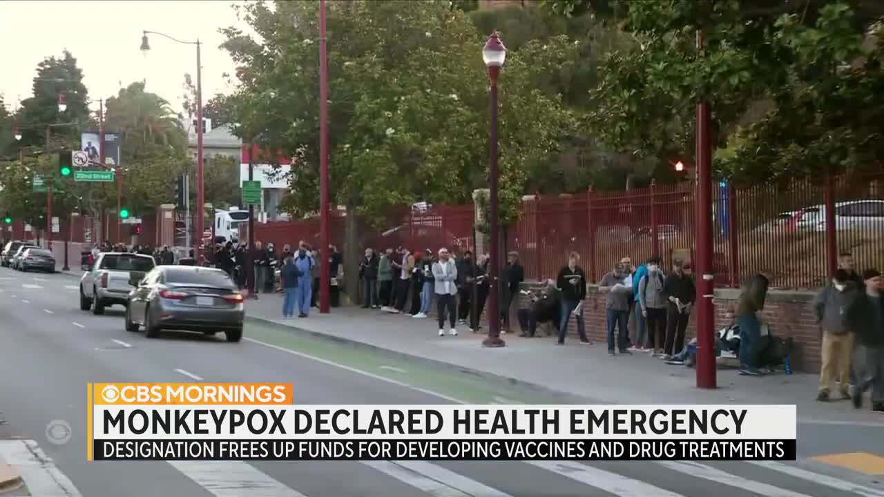 Monkeypox declared a public health emergency as virus spreads nationwide