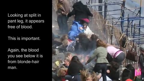 EXPOSED - Boston Bomb Amputee Karen Rand Seen Wiping Fake Blood On Leg After Blast