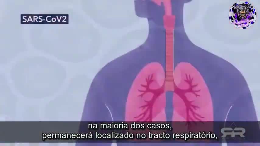 Dr Sucharit Bhakdi acusa - Inoculações/vacinas estão a matar 40% dos inoculados