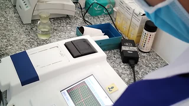 We are measuring quantitative serum amylase