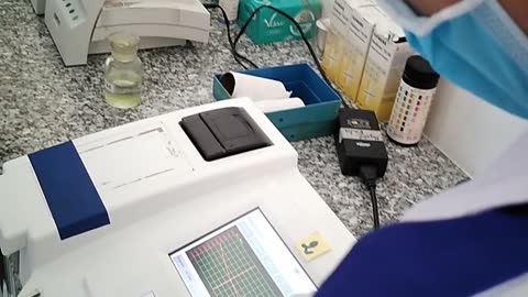 We are measuring quantitative serum amylase