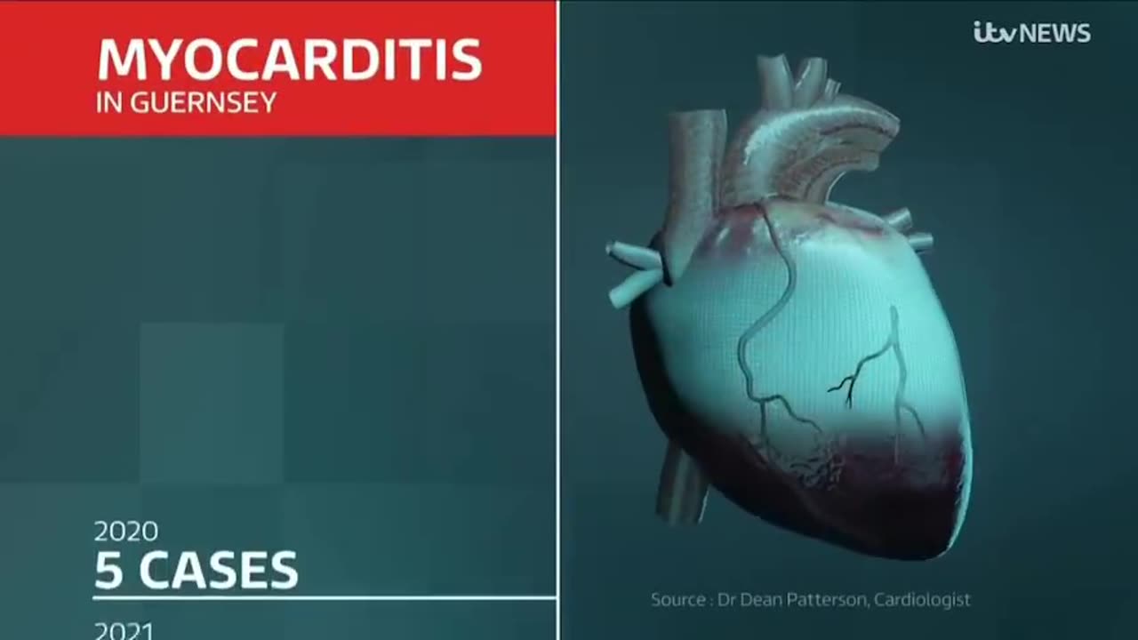 Cardiologist calls for investigation into covid 19 vaccines on British TV