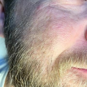 Man's Face Waxing with Tickled Pink Premium Synthetic Hard Wax by Kristi Michelle