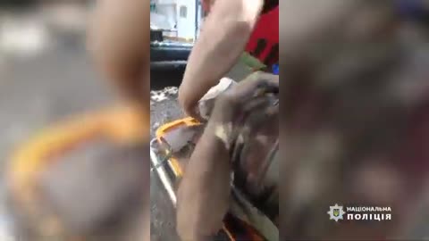 Shelling in Kramatorsk: police paramedics provided first aid to a seriously injured