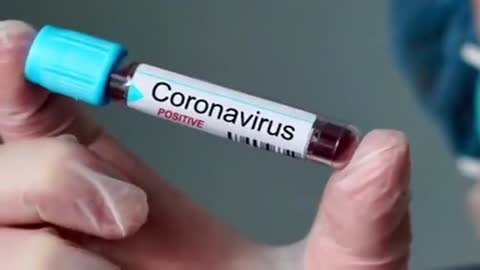 A estranha partida do cientista que descobriu o HIV! Descanse em paz - By Davi