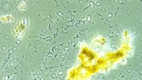 how lemon juice kills bacteria and why does the medical field not tell you this.