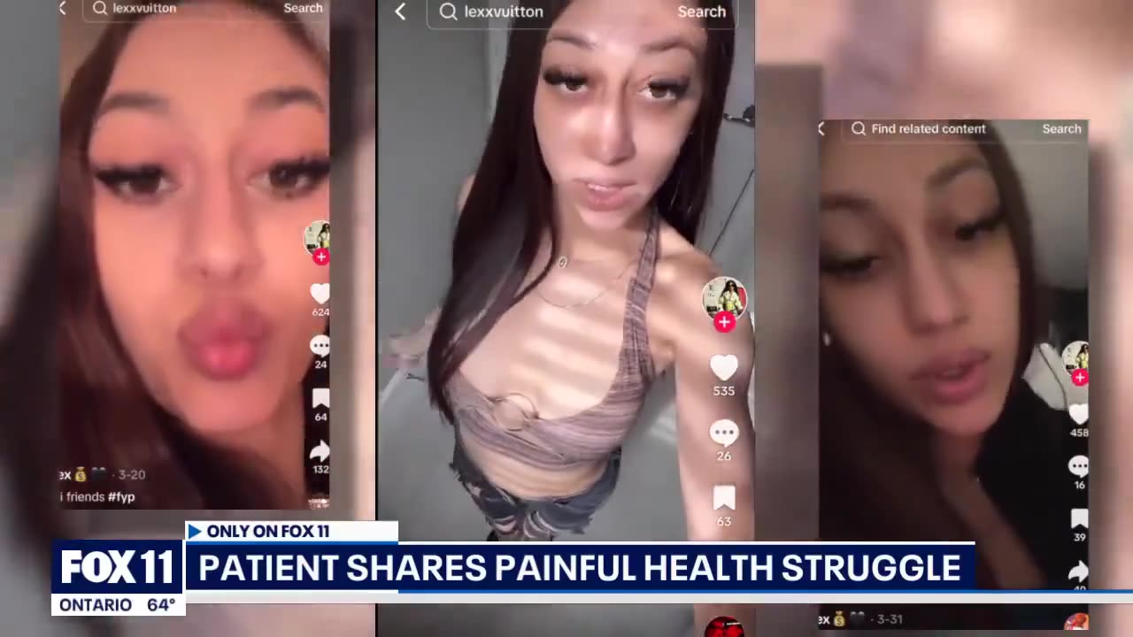 California woman, 23, turns purple after vaccination at a hospital