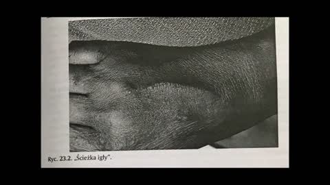 MEDYCYNA SĄDOWA CZ 3 ROZDZIAŁY 17-24