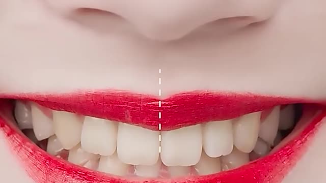 Teeth Cleansing Whitening Mousse Removes Stains Oral Hygiene Mousse