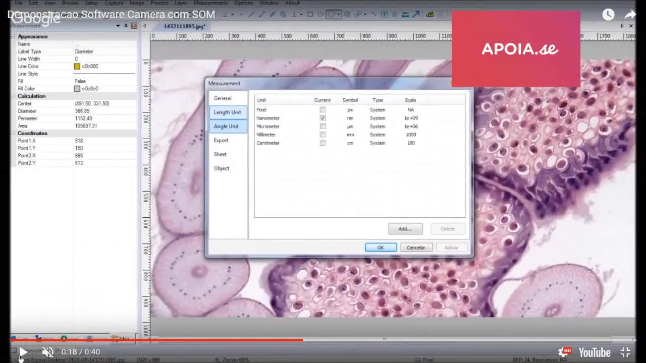 144-Com Microscópio de campo escuro poderemos ver como o plasma age no nosso sangue.