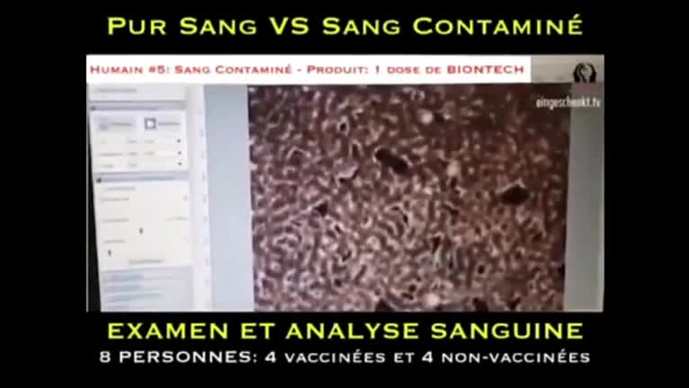 Examen sanguin au microscope : 4 vaxxinés Vs 4 Non vaxxinés