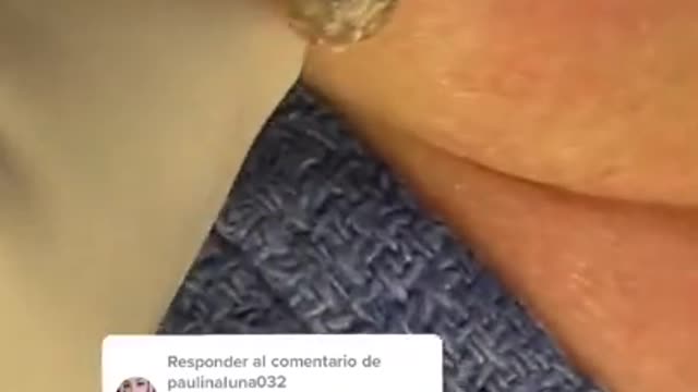 How to remove blackheads from nose, pop pimples, acne treatment #65 #shorts