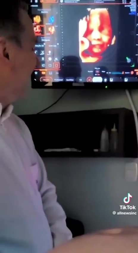 Must See: 32-Week Unborn Baby in the Womb Smiles to Daddy's Voice in Ultrasound