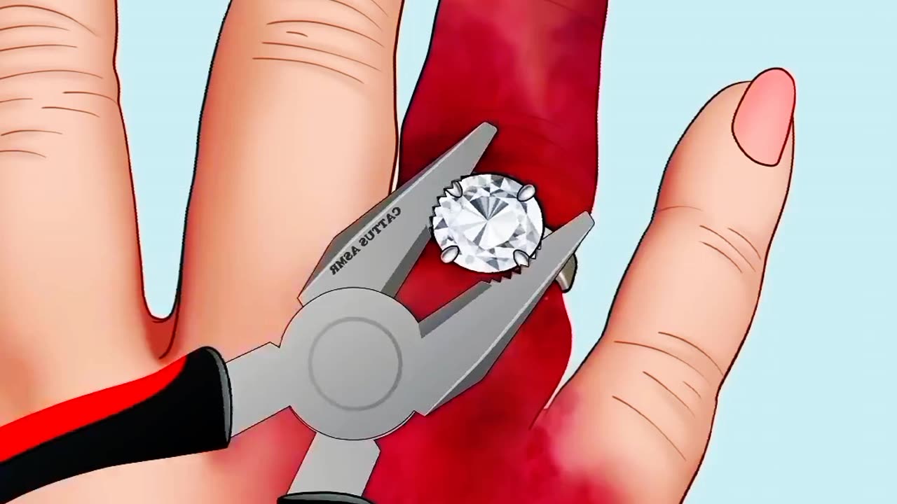 ASMR Treatment Hand So Satisfying P1