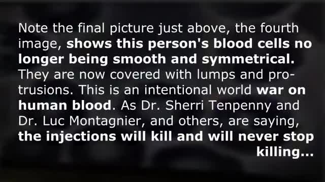 BLOOD BEFORE AND AFTER THE JAB