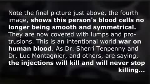 BLOOD BEFORE AND AFTER THE JAB