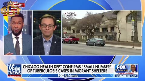 Tuberculosis breaks out at Chicago migrant shelters following measles cases.