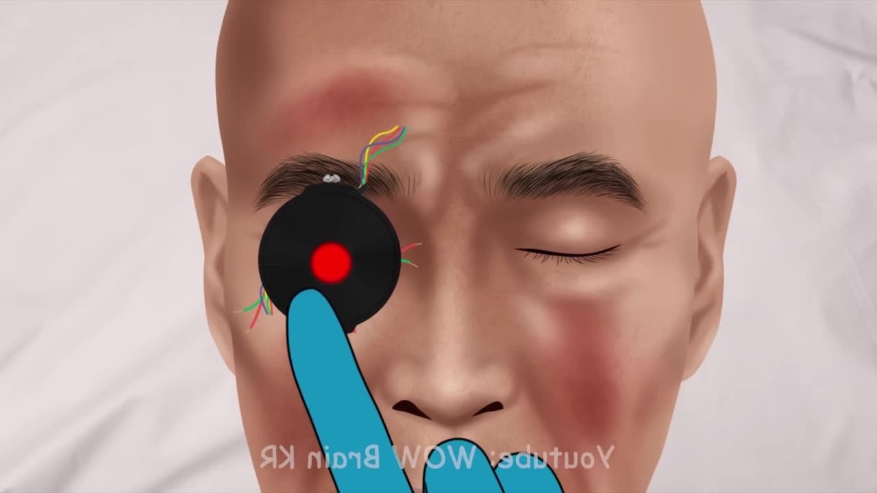 ASMR Help Detainer Astro Toilet upgrade | WOW Brain Satisyfing video | Treatment Animation